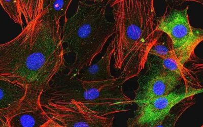 Un fármaco para la artritis reumatoide abre una nueva vía de tratamiento