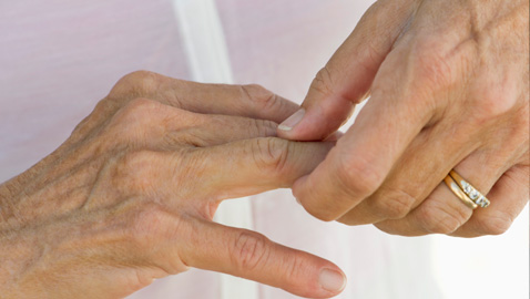 La artritis podría tener su propia terapia celular