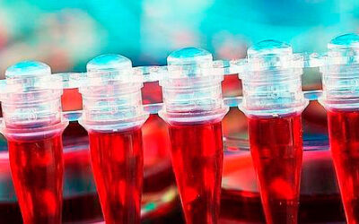 Un test de sangre define qué pacientes con artritis reumatoide fracasarán en su terapia